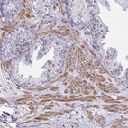 Immunohistochemical staining of human prostate shows moderate cytoplasmic positivity in smooth muscle cells.
