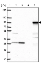 Lane 1: Marker [kDa] 250, 130, 95, 72, 55, 36, 28, 17, 10_br/_Lane 2: Human cell line RT-4_br/_Lane 3: Human cell line U-251MG sp_br/_Lane 4: Human plasma (IgG/HSA depleted)_br/_Lane 5: Human liver tissue