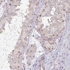 Anti-DZIP1 Antibody