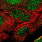 Anti-TET1 Antibody