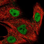 Anti-ZNF574 Antibody