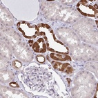 Anti-RBM18 Antibody