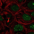 Anti-RBM18 Antibody