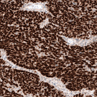 Anti-WT1 Antibody