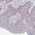 Immunohistochemical staining of human skin shows moderate nuclear positivity in squamous epithelial cells.