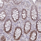 Immunohistochemical staining of human colon shows moderate nuclear positivity in glandular cells.
