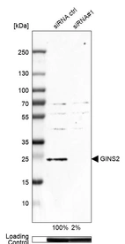 Western blot analysis in MCF-7 cells transfected with control siRNA, target specific siRNA probe #1, using Anti-GINS2 antibody. Remaining relative intensity is presented. Loading control: Anti-GAPDH.