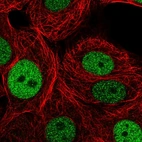 Immunofluorescent staining of human cell line MCF7 shows localization to nucleoplasm.