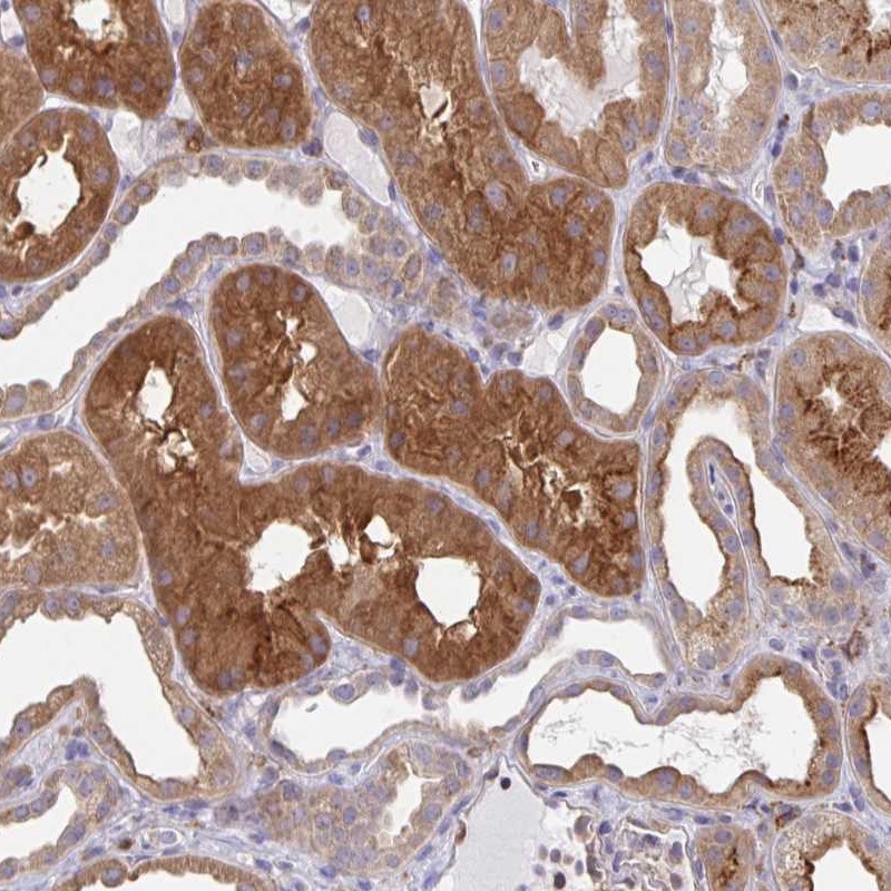 Anti-SNX8 Antibody