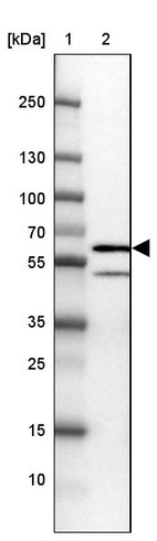 Lane 1: Marker [kDa] 250, 130, 100, 70, 55, 35, 25, 15, 10_br/_Lane 2: Human cell line U-2 OS
