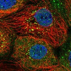 Immunofluorescent staining of human cell line A-431 shows localization to vesicles.