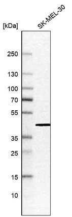 Anti-ATP6V1C1 Antibody