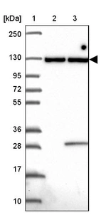 Lane 1: Marker [kDa] 250, 130, 95, 72, 55, 36, 28, 17, 10_br/_Lane 2: Human cell line RT-4_br/_Lane 3: Human cell line U-251MG sp