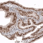 Immunohistochemical staining of human fallopian tube shows strong nuclear positivity in glandular cells.
