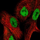 Anti-NFAT5 Antibody