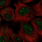 Anti-GON4L Antibody