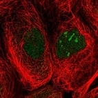 Immunofluorescent staining of human cell line A-431 shows localization to nucleoplasm & nucleoli.