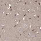 Anti-LPCAT4 Antibody