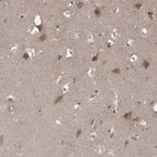 Anti-LPCAT4 Antibody