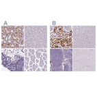 Anti-ATP6V1D Antibody