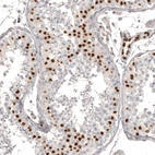 Immunohistochemical staining of human testis shows strong nuclear positivity in cells in seminiferous ducts.