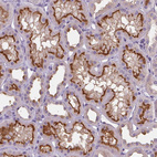 Anti-ATP6V1D Antibody