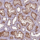 Immunohistochemical staining of human kidney shows moderate membranous positivity in cells in tubules.