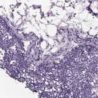 Immunohistochemical staining of human lymph node shows no positivity in non-germinal center cells as expected.