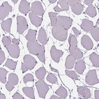 Immunohistochemical staining of human skeletal muscle shows no positivity in myocytes as expected.