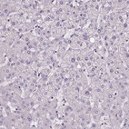 Immunohistochemical staining of human liver shows no positivity in hepatocytes as expected.