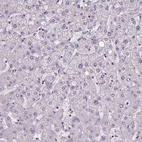 Anti-ATP6V1D Antibody