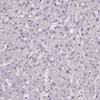 Immunohistochemical staining of human liver shows no positivity in hepatocytes as expected.