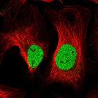 Immunofluorescent staining of human cell line U-2 OS shows localization to nucleoplasm.