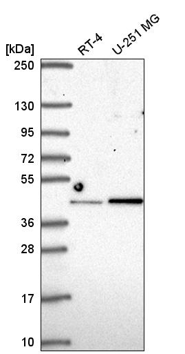 Anti-IRF2 Antibody