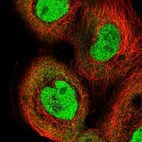 Immunofluorescent staining of human cell line A-431 shows localization to nucleoplasm & cytosol.
