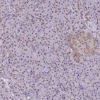 Anti-ING4 Antibody
