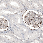 Immunohistochemical staining of human kidney shows strong nuclear positivity in cells in glomeruli.