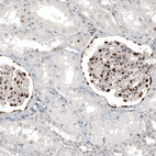 Anti-WT1 Antibody