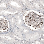 Immunohistochemical staining of human kidney shows strong nuclear positivity in cells in glomeruli.