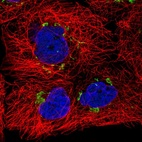 Anti-SLC30A6 Antibody