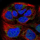 Anti-HPDL Antibody