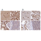 Immunohistochemical staining of human cerebral cortex, heart muscle, kidney and pancreas using Anti-ATP5F1 antibody HPA057347 (A) shows similar protein distribution across tissues to independent antibody HPA046067 (B).