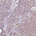 Immunohistochemical staining of human pancreas shows low expression as expected.