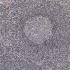 Immunohistochemical staining of human lymph node shows no positivity in germinal center cells as expected.