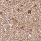 Immunohistochemical staining of human cerebral cortex using Anti-ATP5F1 antibody HPA057347.