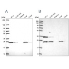 Anti-ATP5F1 Antibody