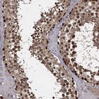 Anti-FBXO7 Antibody