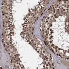 Anti-FBXO7 Antibody