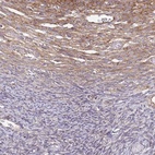 Anti-EEF2 Antibody