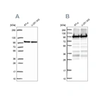 Western blot analysis using Anti-EEF2 antibody HPA057351 (A) shows similar pattern to independent antibody HPA040534 (B).